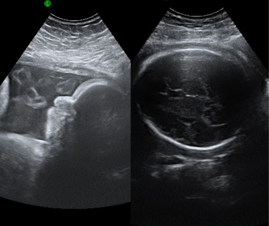 ultrasound direct presentation scan